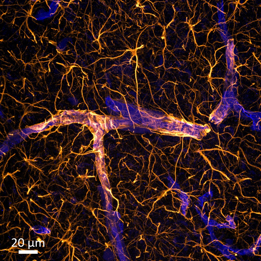 Neuroscience-inspired visual showing astrocyte and neural structures
